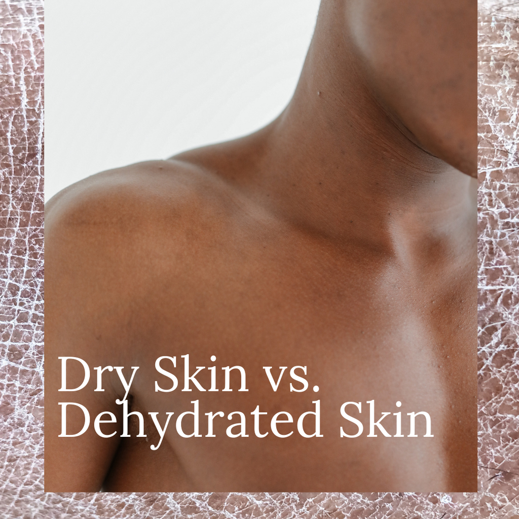 Dehydrated vs Dry skin