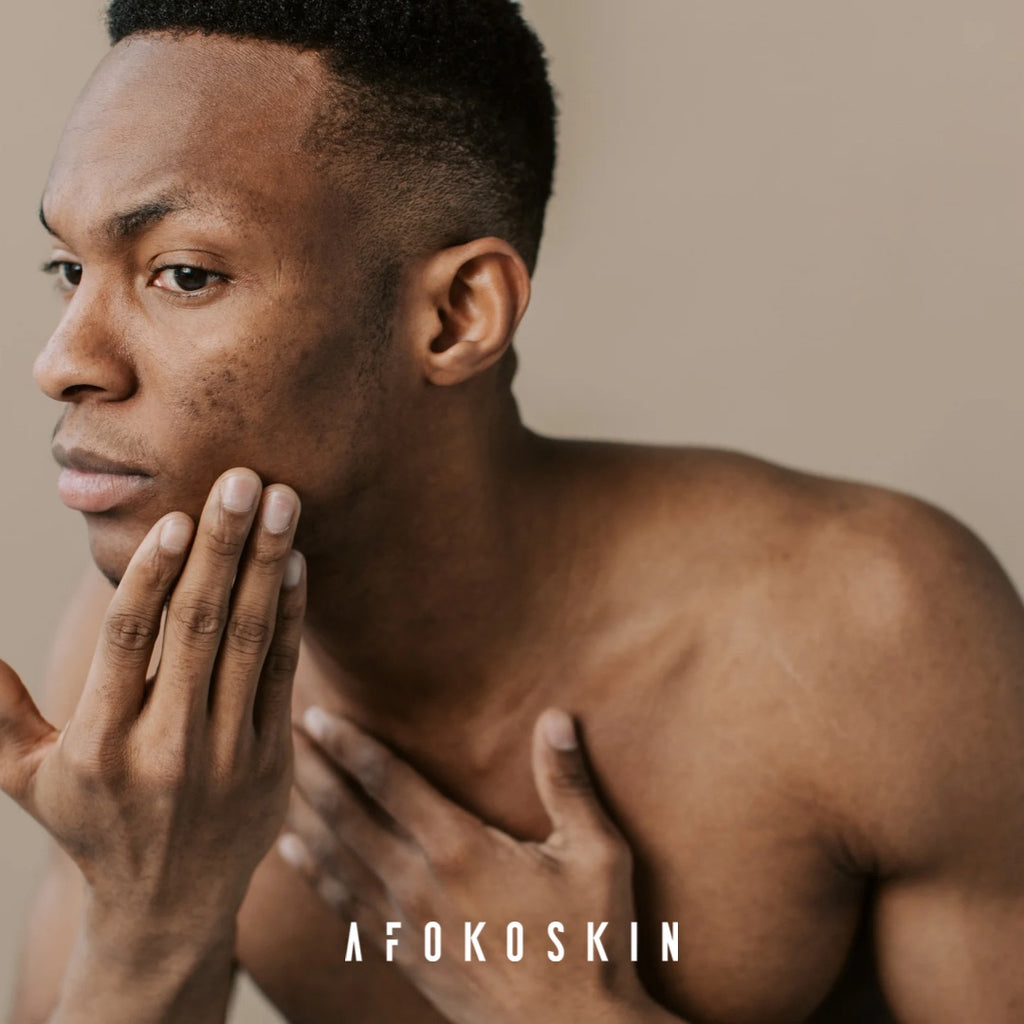 The Power of African Black Soap for Hyperpigmentation